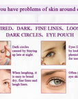Eye Gel For Wrinkles & Eyebags