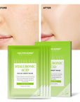 Hyaluronic Acid Hydrating Facial Sheet Mask