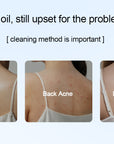 Salicylic Acid Body Wash For Acne Prone Skin -500ml