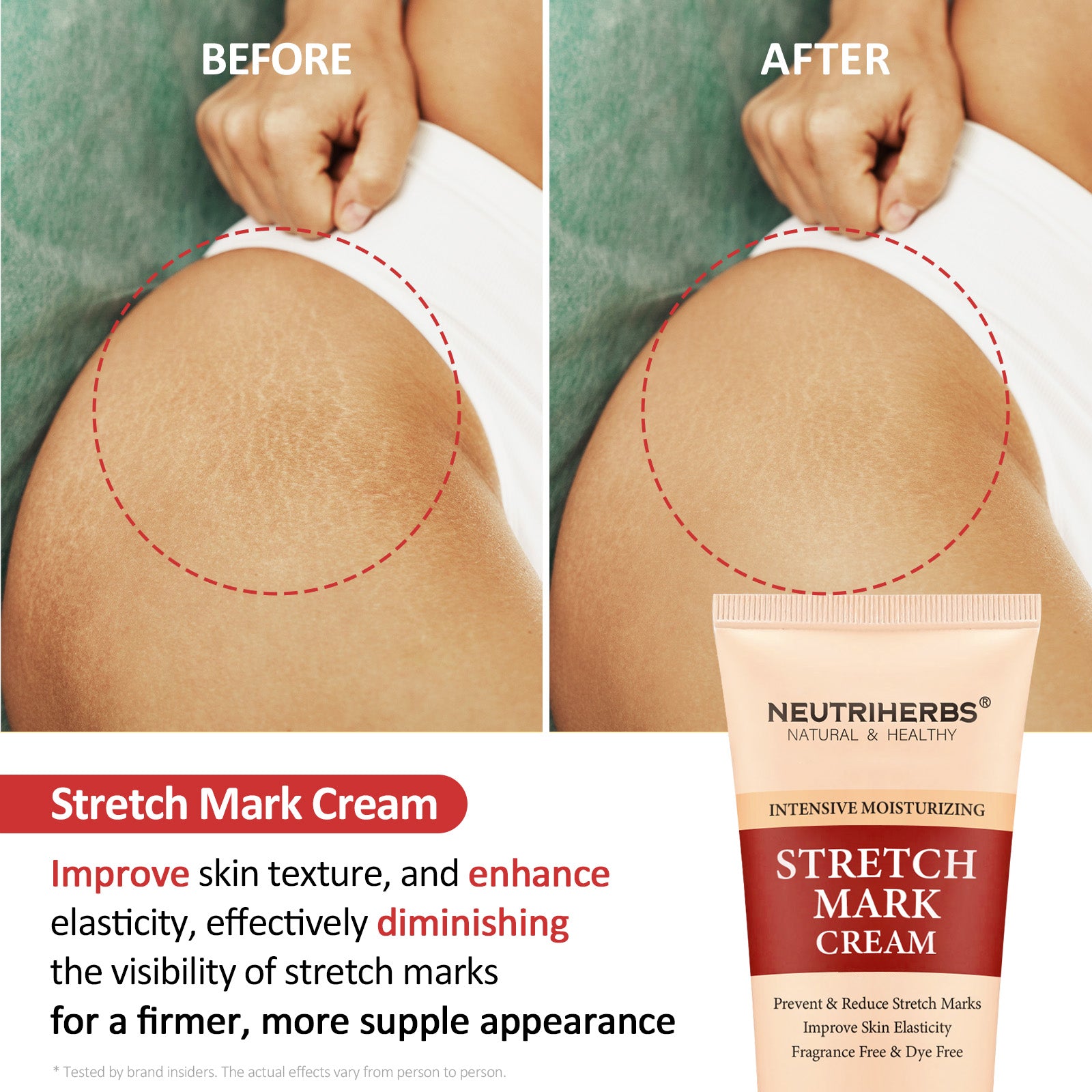 Intensive Stretch Mark Cream For  Smoother Resilient Skin