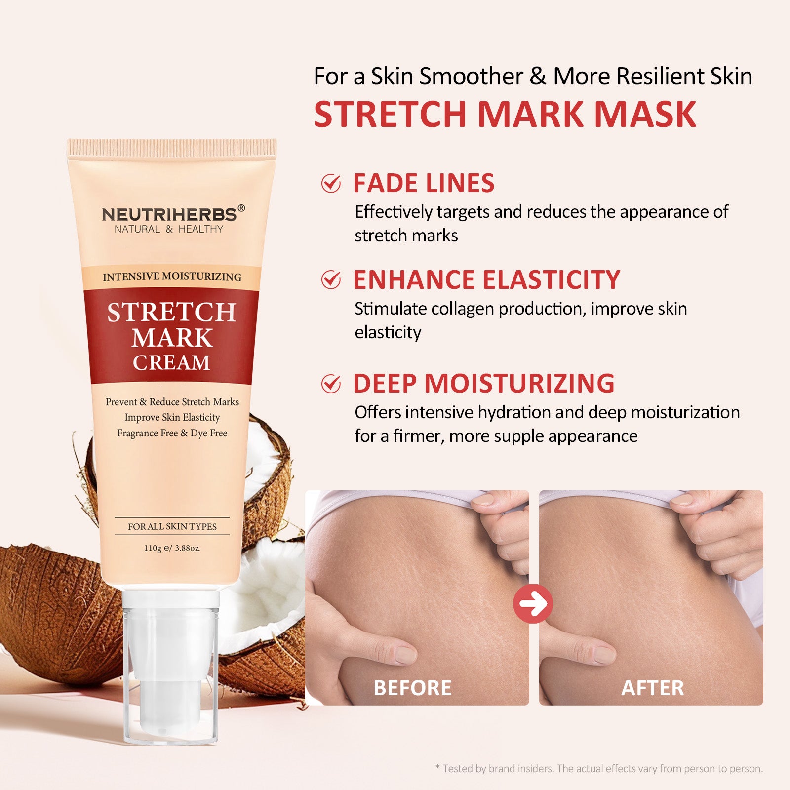 Intensive Stretch Mark Cream For  Smoother Resilient Skin