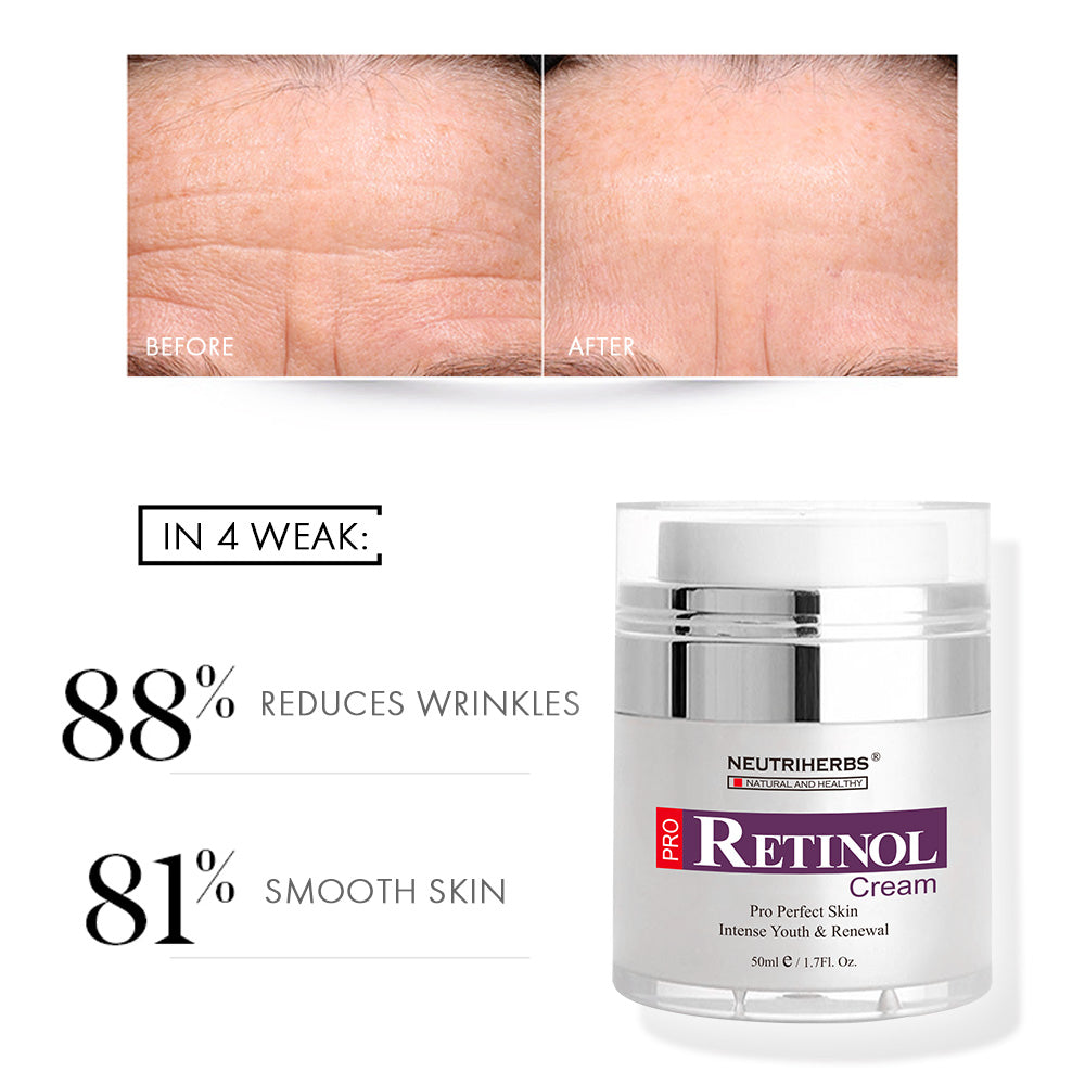 Retinol Cream For Acne &amp; Anti Aging - 50g