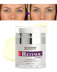 Retinol Cream For Acne & Anti Aging - 50g