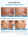 Salicylic Acid Skin Toner | 100ml
