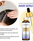 Intense Hair Growth Serum For Hair Density - 30ml