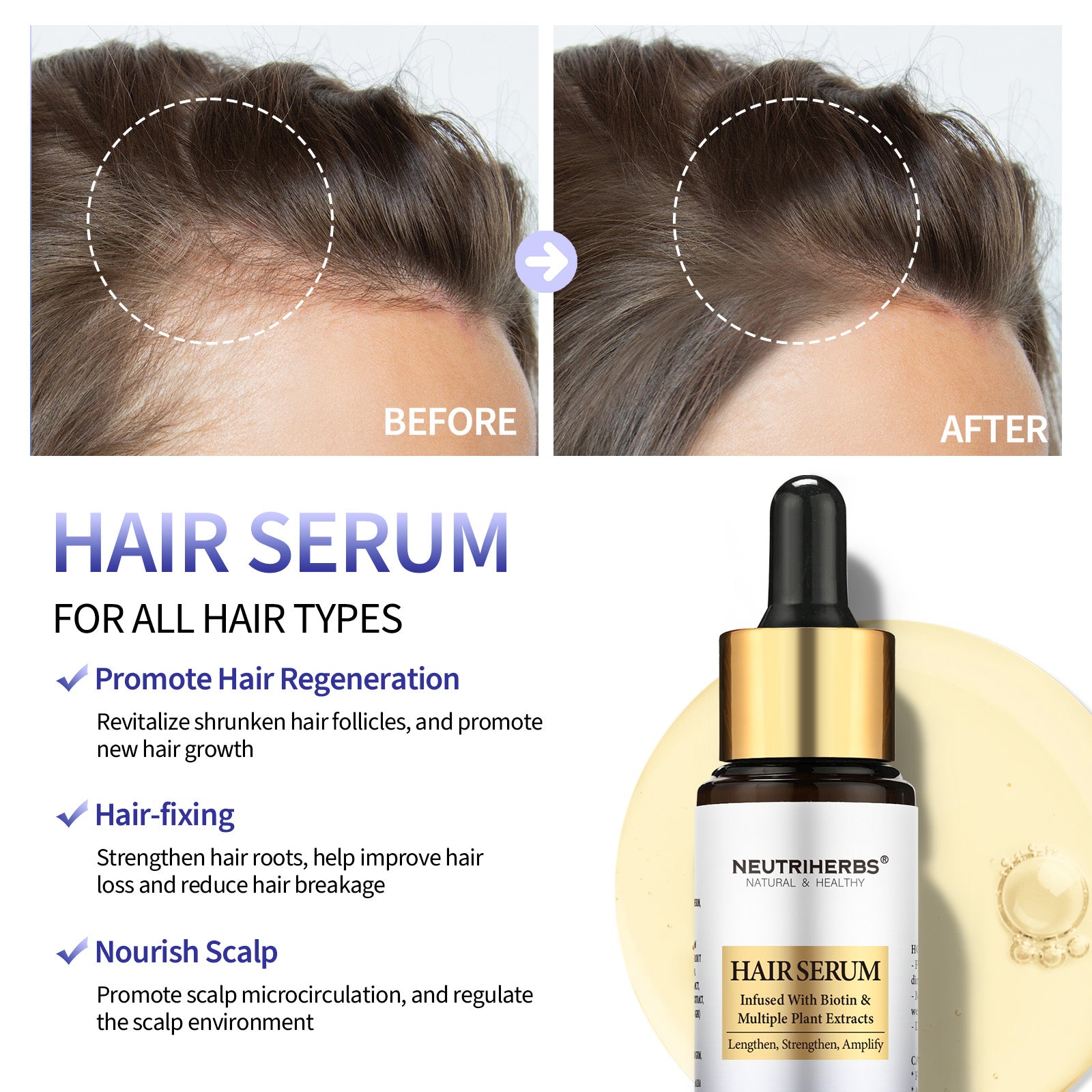 Intense Hair Growth Serum For Hair Density - 30ml