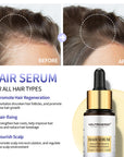 Intense Hair Growth Serum For Hair Density - 30ml