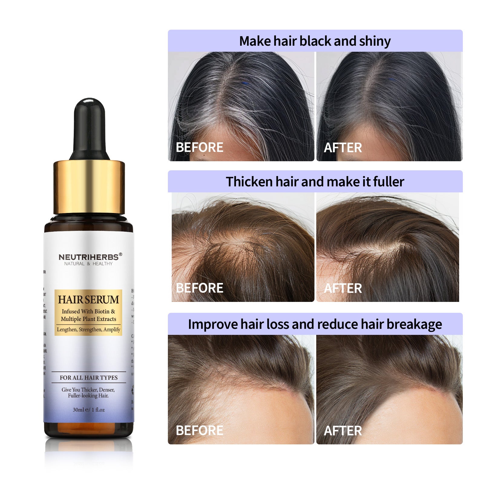 Intense Hair Growth Serum For Hair Density - 30ml