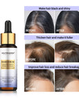 Intense Hair Growth Serum For Hair Density - 30ml