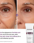 Pro Retinol Eye Cream - 15g