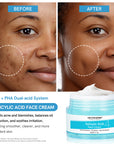 Salicylic Acid Face Cream | 50g