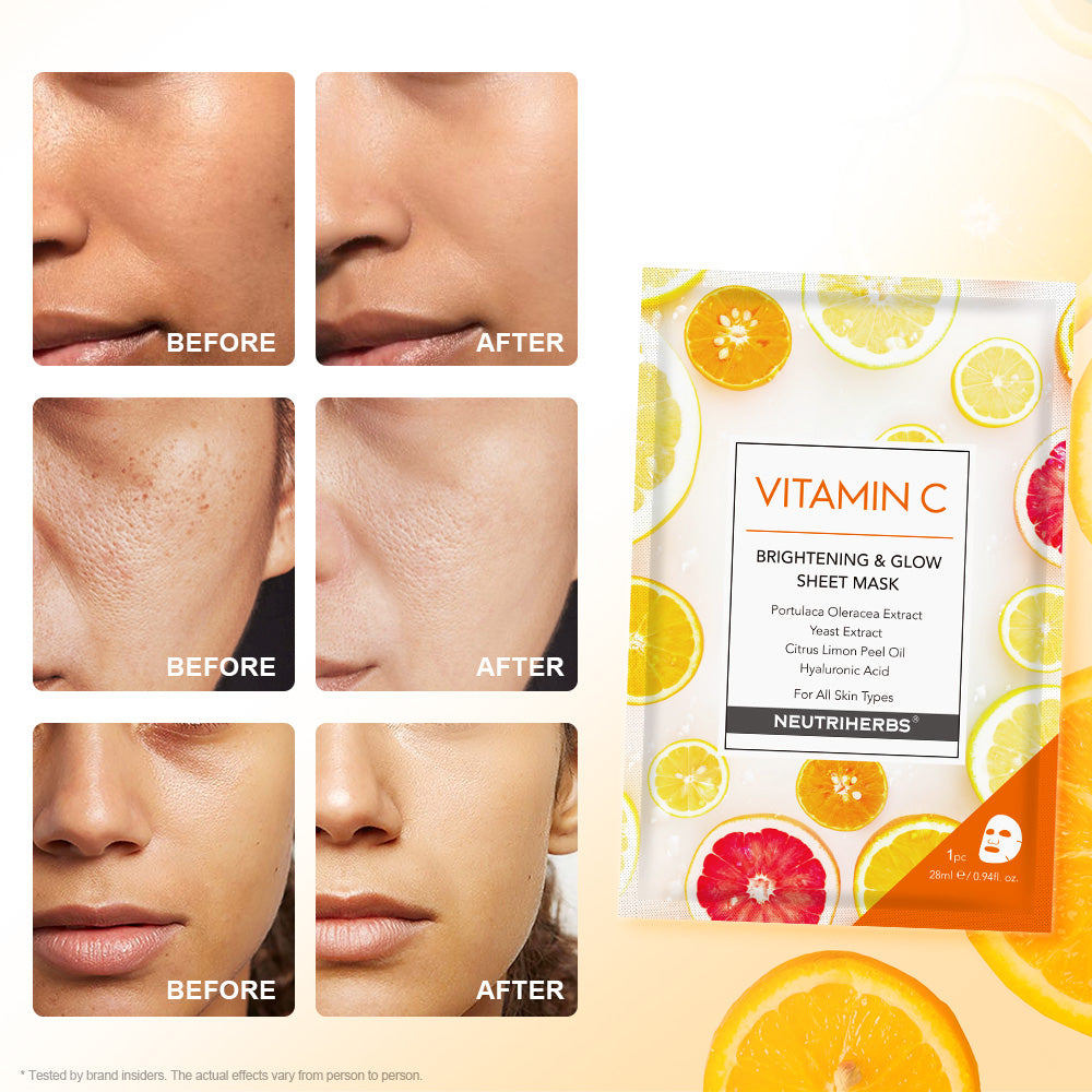 Vitamin C Facial Sheet Mask - 5pcs