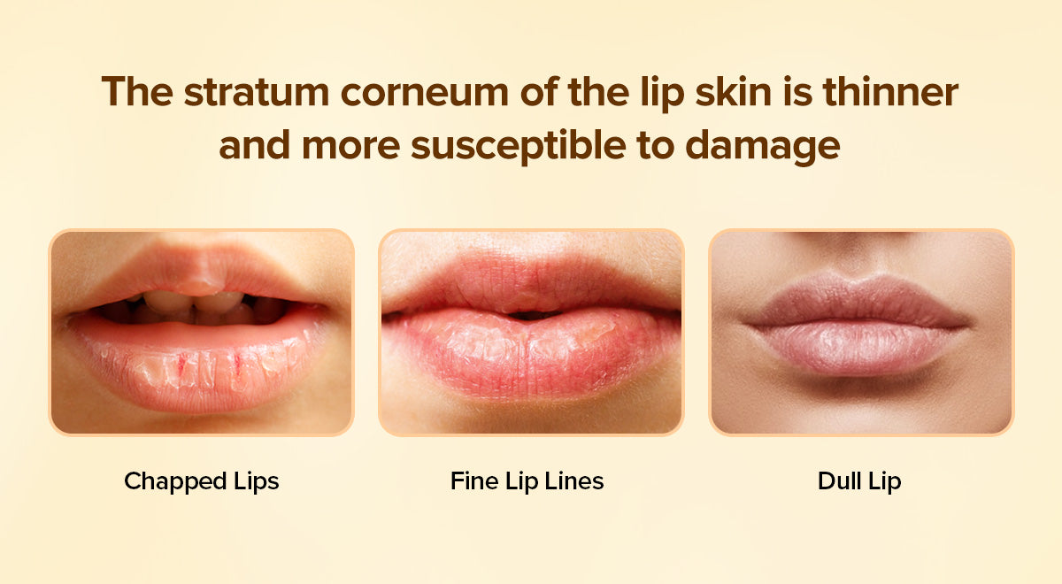 Vitamin C Brightening & Glow Lip Treatment Cream Neutriherbs Vitamin C Brightening & Glow Lip Treatment Cream Neutriherbs