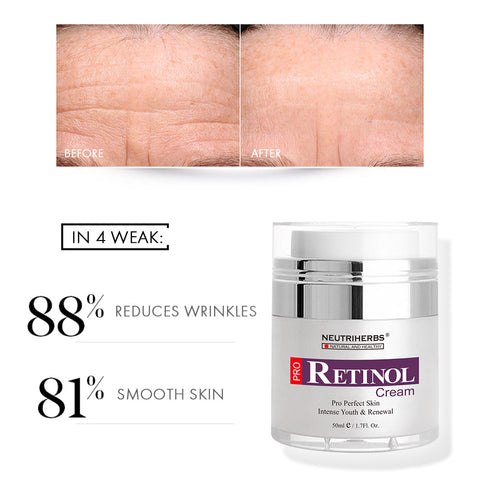 Retinol Cream For Acne & Anti Aging - 50g