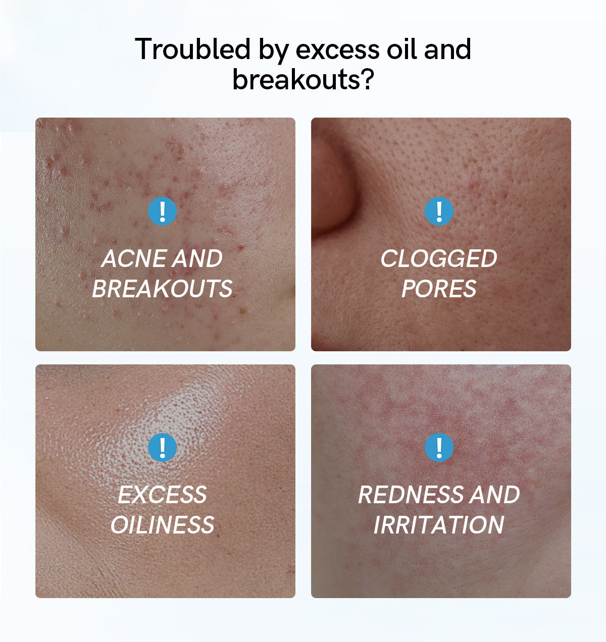 Salicylic Acid Skin Toner  | 100ml