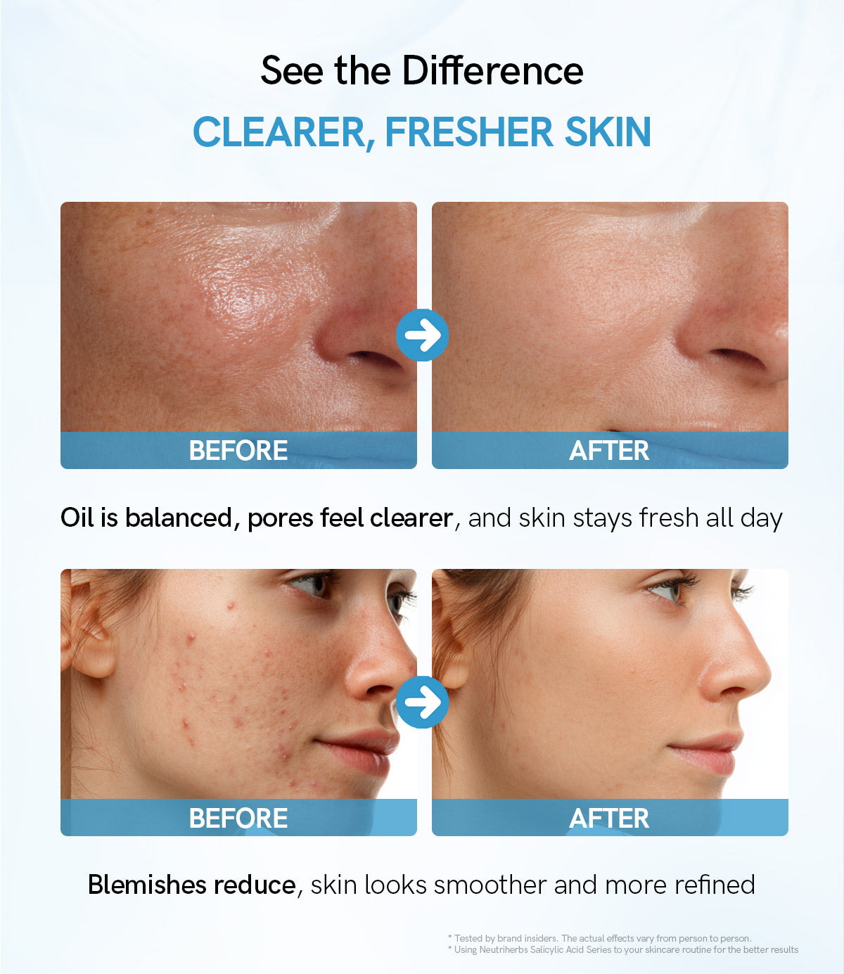 Salicylic Acid Skin Toner  | 100ml